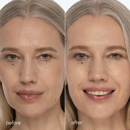 Before and after Maree Collagen and Retinol Toner Pads